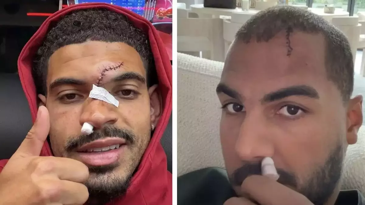 Morgan Gibbs-White ve Robert Sanchez'in yüzünün son durumu korkuttu